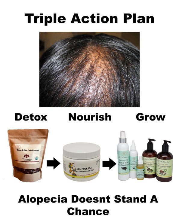 Got Alopecia? We've Got A Plan! Hair Loss Action Plan - Red's Kitchen Sink